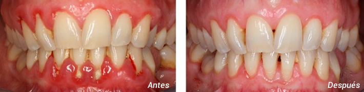 Pestaña periodoncia01
